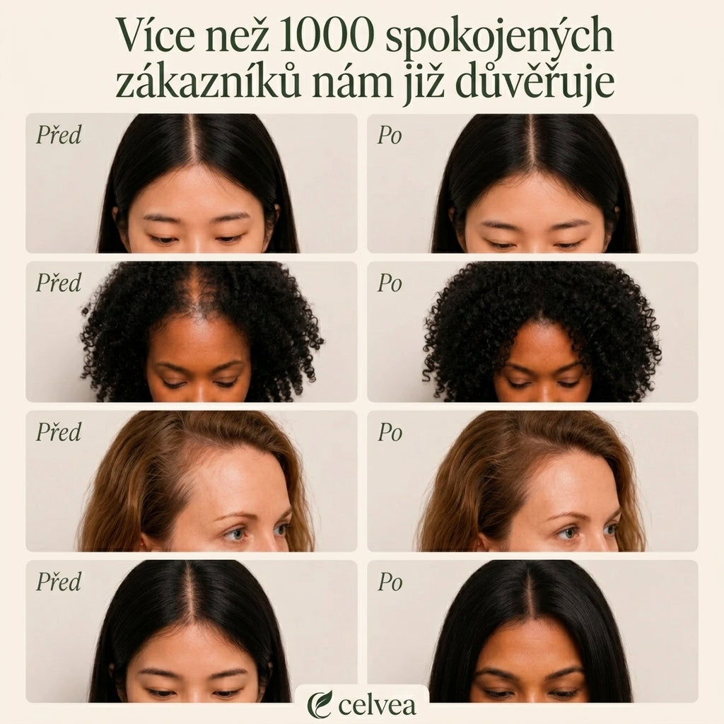 Korejský tuhý šampon proti vypadávání vlasů
