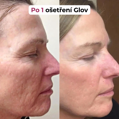 Celvea micro needle serum