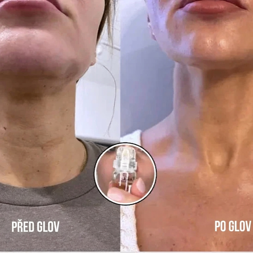 Celvea micro needle serum
