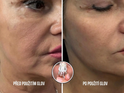 Celvea micro needle serum