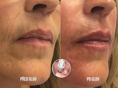 Celvea micro needle serum