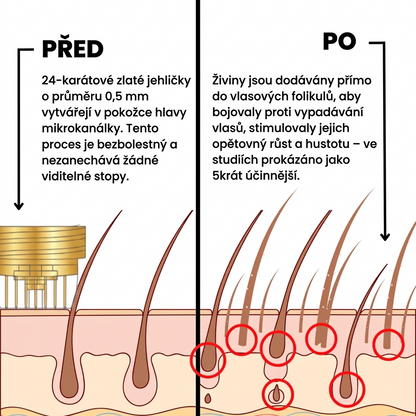 Hair Regrowth System Microneedle Essence