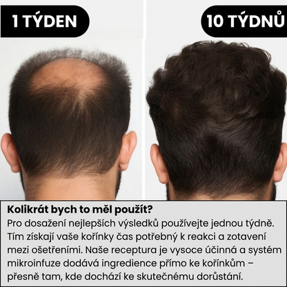Hair Regrowth System Microneedle Essence