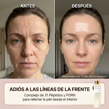 Celvea EGF Tox Toner | Tónico antiarrugas y reafirmante | K-Beauty
